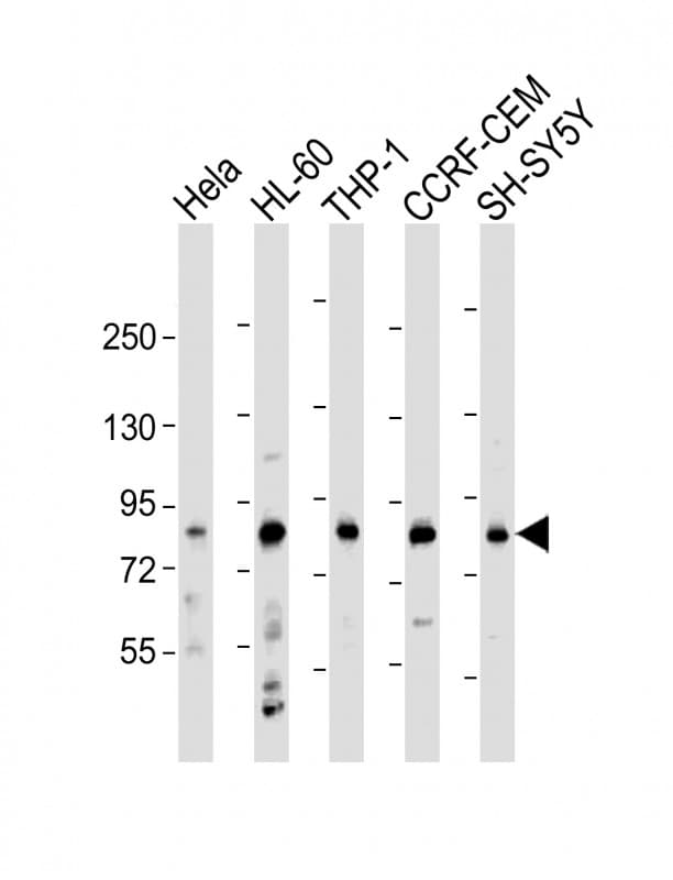 LRCH4 Antibody (Internal)