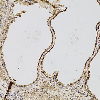 FGF2 / Basic FGF Antibody