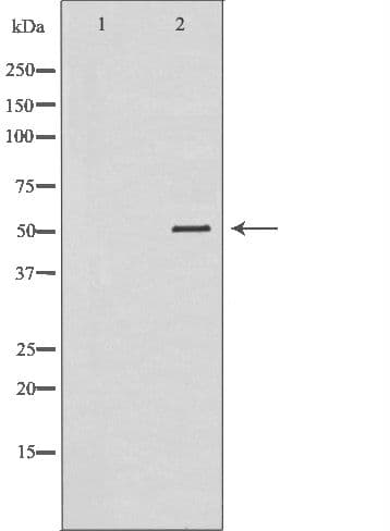 Polyclonal Rabbit anti-Human SRPX Antibody (IHC, WB)