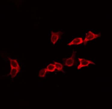 Polyclonal Rabbit anti-Human EFNA2 / Ephrin A2 Antibody (IF, WB)