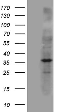 Monoclonal Mouse anti-Human NAT1 / AAC1 Antibody (clone OTI7G6, WB)