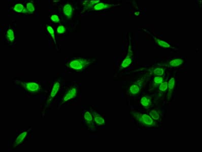 IHC-plus™ C1D Antibody (aa1-135)
