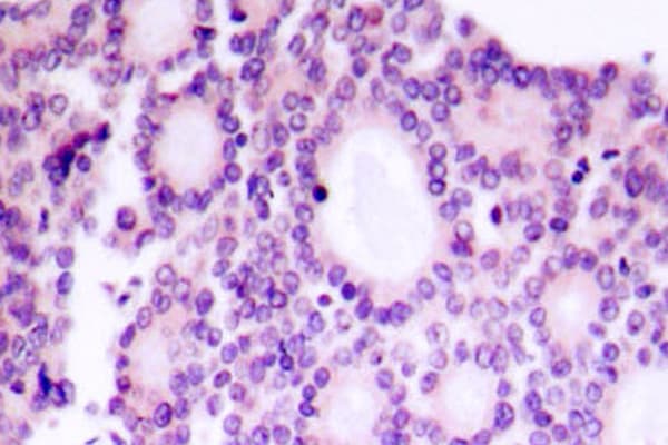 MYC / c-Myc Antibody (Arg367)