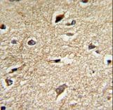 Polyclonal Rabbit anti-Human BAG1 / BAG-1 Antibody (aa258-285, IHC, IF, WB)
