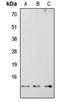 RBBP6 Antibody (Internal)