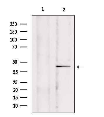 Polyclonal Rabbit anti-Human MCU / CCDC109A Antibody (WB)