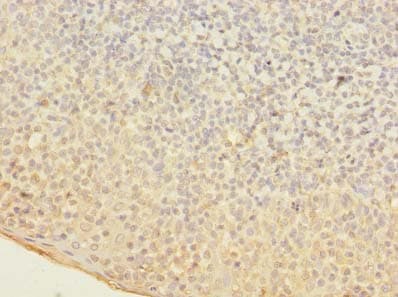 OGG1 Antibody