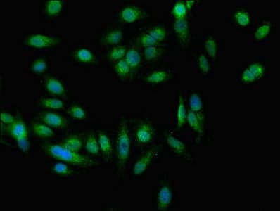 Polyclonal Rabbit anti-Human EEA1 Antibody (IHC, IF, WB)