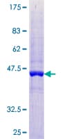 Human UFC1 Protein (Recombinant GST)