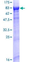 Human RABGGTA Protein (Recombinant GST)