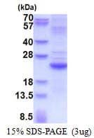 Human IFNL2 / IL28A Protein (Recombinant His)