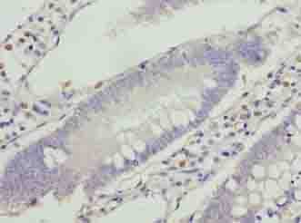 VPS25 Antibody