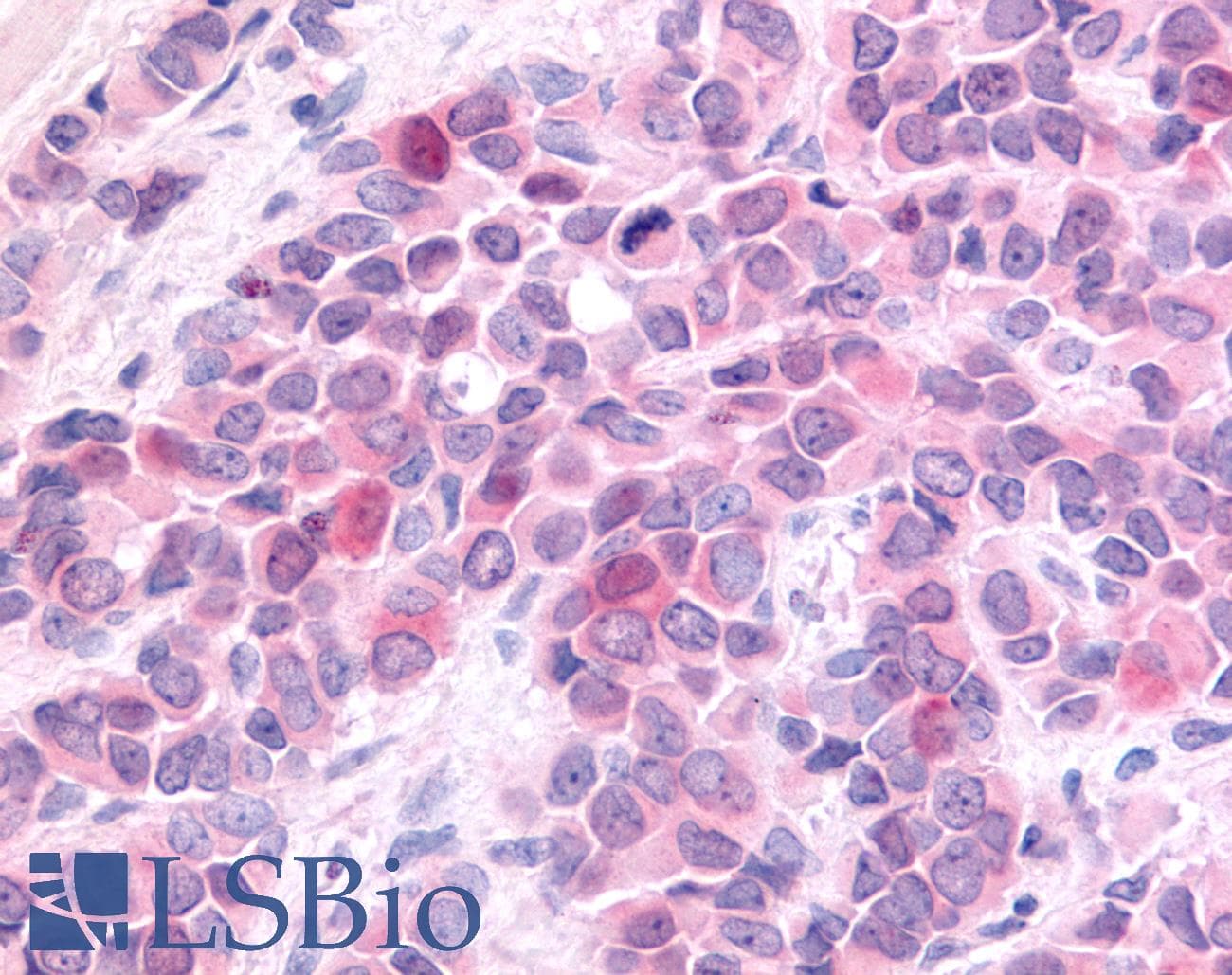 PathPlus™ Polyclonal Rabbit anti-Human HUNK / B19 Antibody (Internal, IHC)