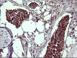 MMP13 Antibody (aa104-471, clone OTI2D8)