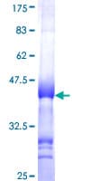 Human SSX4 Protein (Recombinant GST, N-terminus)