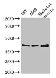 Polyclonal Rabbit anti-Human GALT4 / B3GALT4 Antibody (IHC, WB)