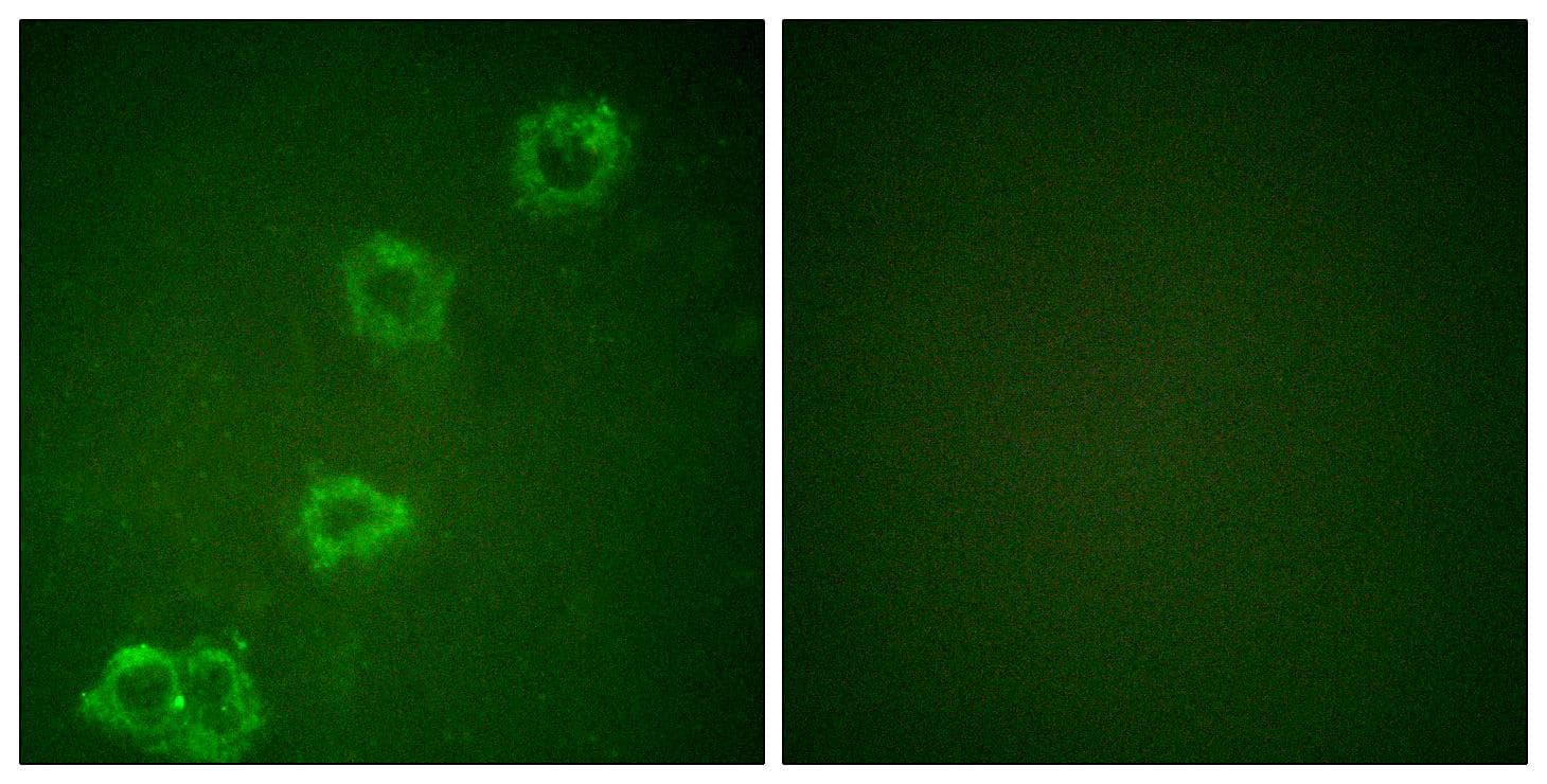 BACE1 / BACE Antibody
