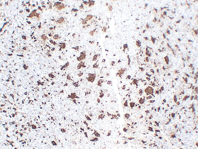 ACP5 / TRAP Antibody (clone ABT-TRAP)