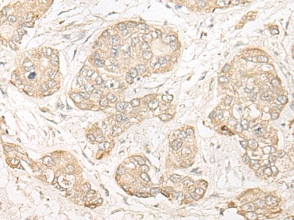 COMT Antibody