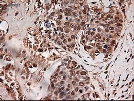 TRIM33 / TIF1-Gamma Antibody (clone OTI9D4)