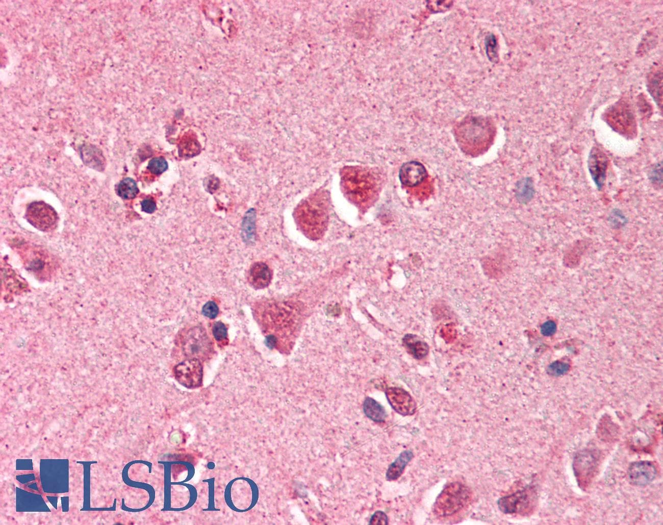 IHC-plus™ MAD2L1 / MAD2 Antibody (aa1-25)