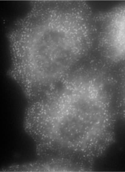 IHC-plus™ Polyclonal Goat anti-Human AP2A1 / AP2-Alpha Antibody (aa706-727, IHC, WB)