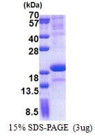 Human SCN3B Protein (Recombinant His, N-Terminal)