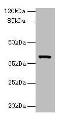ARG2 / Arginase 2 Antibody