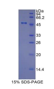 Pig TIMP4 Protein (Recombinant His-GST)