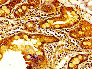 KDM6A / UTX Antibody