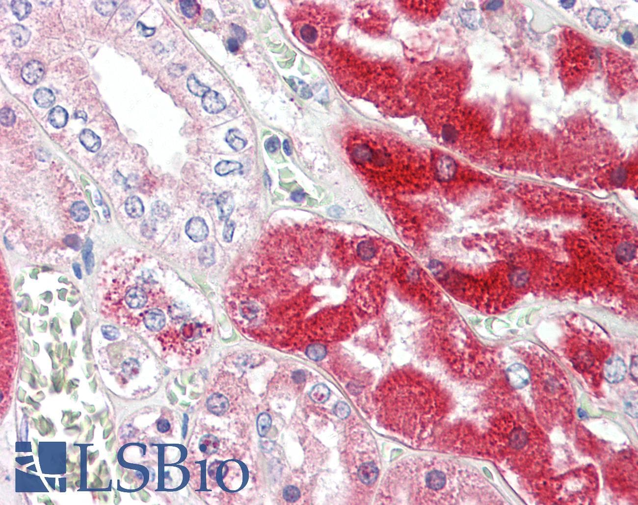 IHC-plus™ Polyclonal Goat anti-Human DCXR Antibody (aa232-244, IHC, WB)