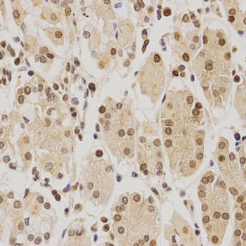 Polyclonal Rabbit anti-Human BMI1 / PCGF4 Antibody (IHC, IF, WB)