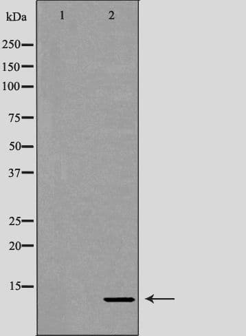 RBX1 / ROC1 Antibody