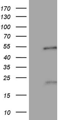 NR5A1 / SF1 Antibody (aa1-262, clone OTI1F2)