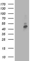 TMPRSS5 Antibody (clone OTI6G10)