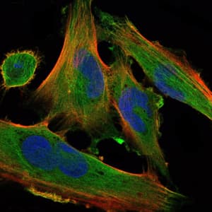 DLK1 / Pref-1 Antibody (clone 3A10)