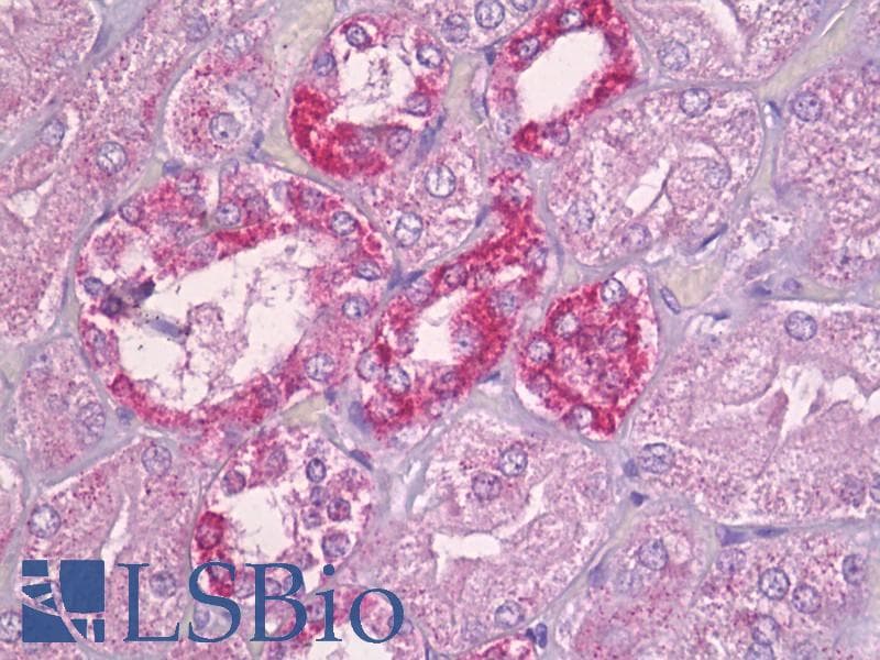IHC-plus™ Polyclonal Rabbit anti-Human FE65L1 / APBB2 Antibody (aa471-520, IHC, WB)