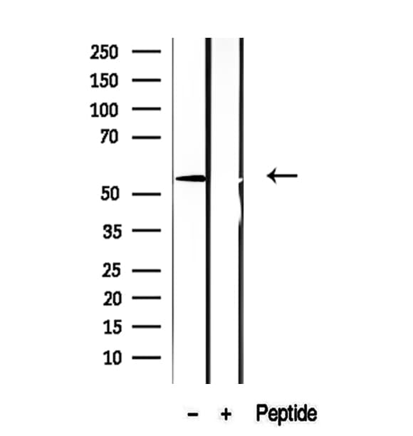 Polyclonal Rabbit anti-Human ASAH1 / Acid Ceramidase Antibody (IHC, WB)