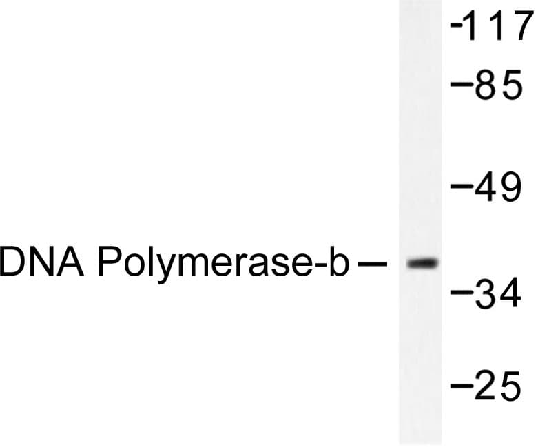 POLB / DNA Polymerase Beta Antibody (Gln324)