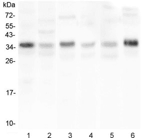 Polyclonal Rabbit anti-Human CD40L Antibody (WB)