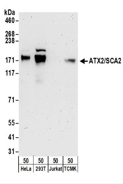 ATXN2 / SCA2 / Ataxin-2 Antibody (aa1262-1312)
