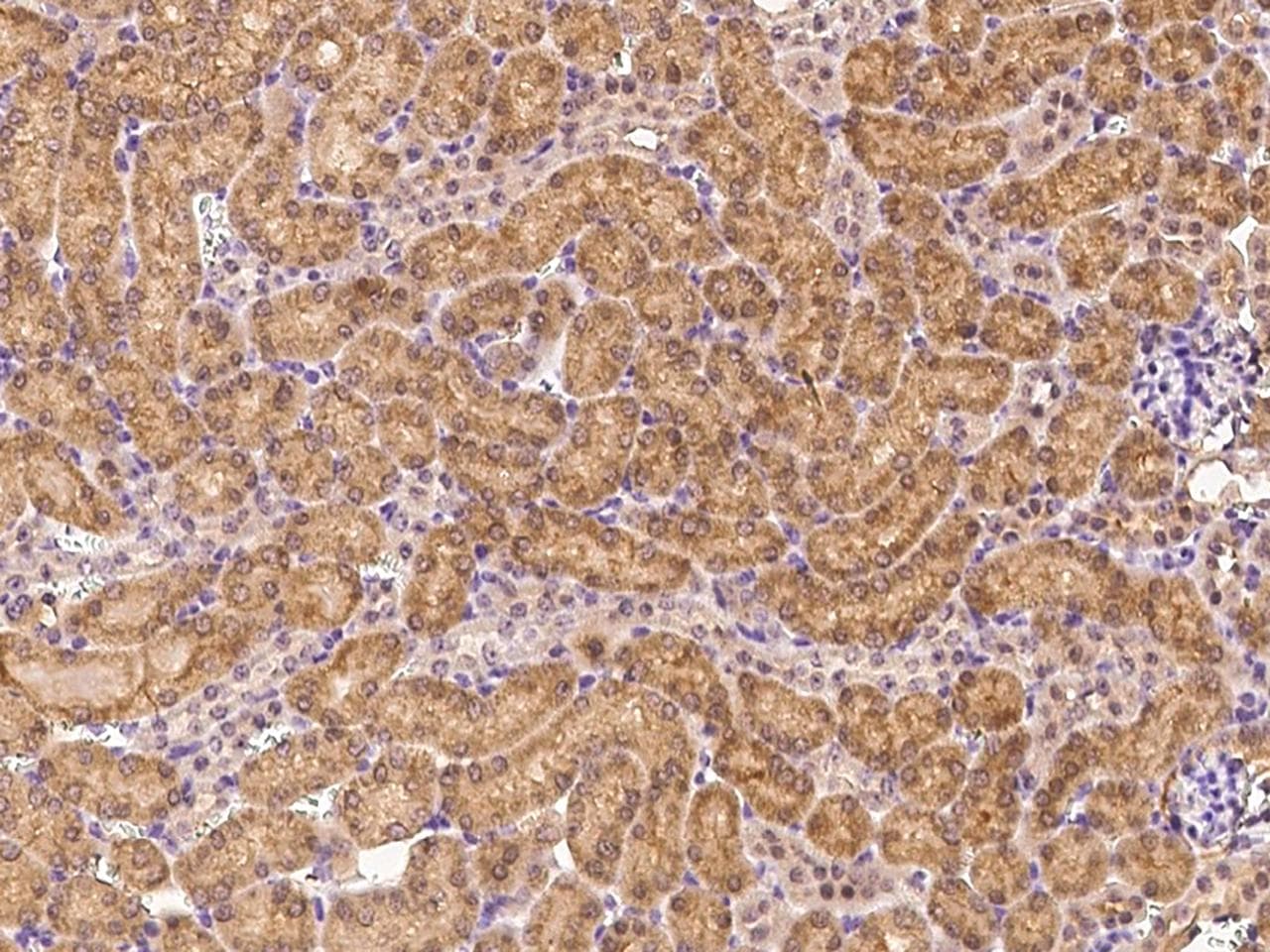 Polyclonal Rabbit anti-Mouse FGFR3 Antibody (IHC)