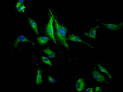 Polyclonal Rabbit anti-Human PEAR1 Antibody (IHC, IF, WB)