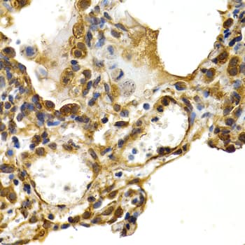 Polyclonal Rabbit anti-Human HSPB8 / H11 / HSP22 Antibody (IHC, IF, WB)