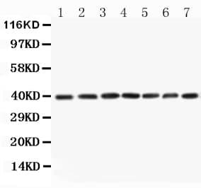 Polyclonal Rabbit anti-Human MAP2K3 / MEK3 / MKK3 Antibody (aa42-58, WB)
