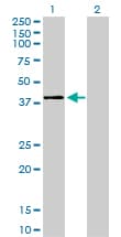 Monoclonal Mouse anti-Human MAPK11 / SAPK2 / p38 Beta Antibody (clone 1F9, WB)