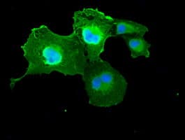 Monoclonal Mouse anti-Human DFFA / ICAD / DFF45 Antibody (clone OTI5C4, IF, WB)