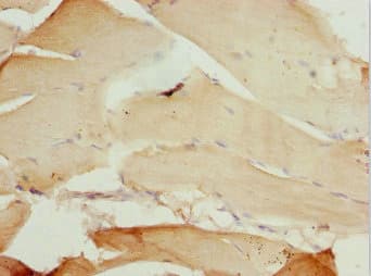 Polyclonal Rabbit anti-Human TAF11 Antibody (IHC)