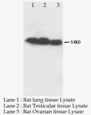 MMP8 Antibody (N-Terminus)