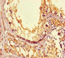 LPAL2 Antibody